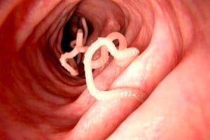 Pictorial representation of tapeworm inside human intestine. Platyhelminthes or flatworm mostly live as parasites in the bodies of other animals